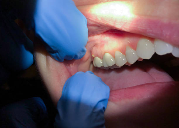 Best Broken Tooth Emergency  in Atco, NJ